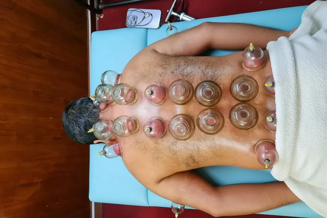 A patient showing peace and wellness after receiving Hijama cupping therapy